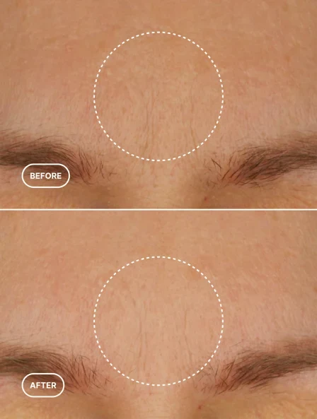 THE PHYTO-RETINOL | Evening Ritual